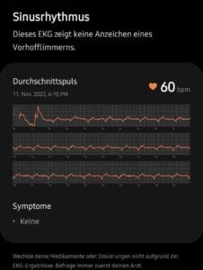 Der SAMSUNG Galaxy Watch5 Pro Test: optisch schick und sexy - aber wie gut ist die Uhr?..