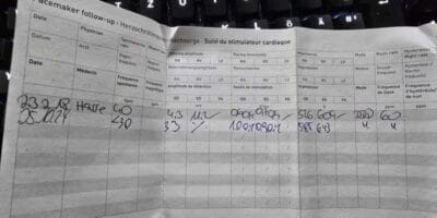 Monatsrückblick Oktober 2024 - Au Backe, mein Zahn.. 9 Monatsrückblick Oktober 2024 - Au Backe, mein Zahn..