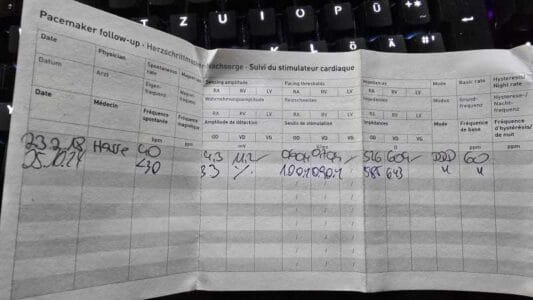 Monatsrückblick Oktober 2024 - Schrittmacherkontrolle? Wer braucht das?